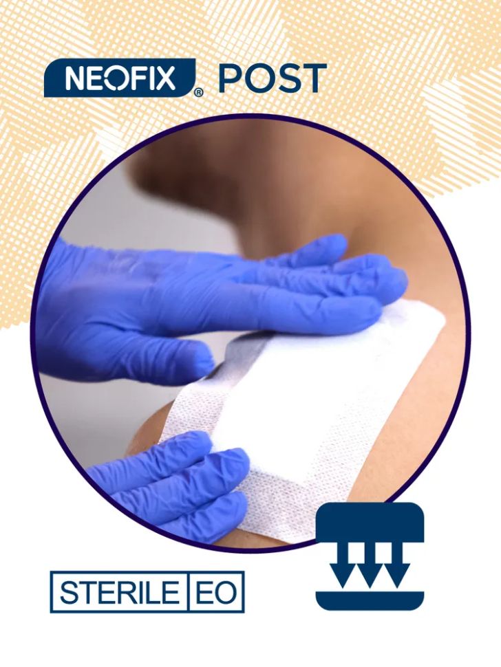 NEOFIX: Повязка самоклеящаяся послеоперационная NEOFIX POST, 7х5 см, 50 шт.